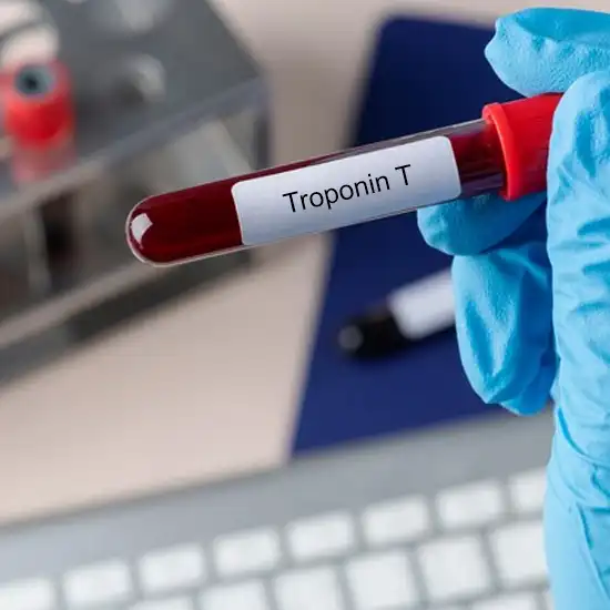 Troponin T Quantitative (Serum) Test